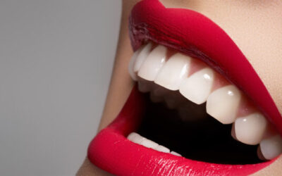 Take Care of Your Teeth