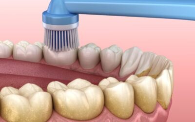 Electrical Toothbrush: Most Dentists’ Preferred Choice