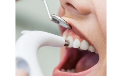 Do scaling and polishing make teeth weak?
