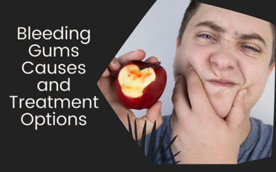 What Are The Common Bleeding In Gums Causes?