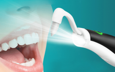 DIY vs. Professional Teeth Cleaning: What’s Best for Your Oral Health?